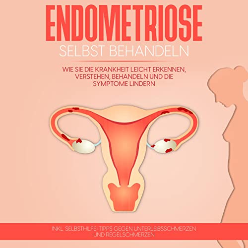 Endometriose selbst behandeln: Wie Sie die Krankheit leicht erkennen, verstehen, behandeln und die Symptome lindern - inkl. Selbsthilfe-Tipps gegen Unterleibsschmerzen und Regelschmerzen  