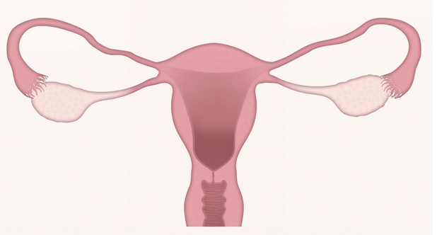 Endometriose  